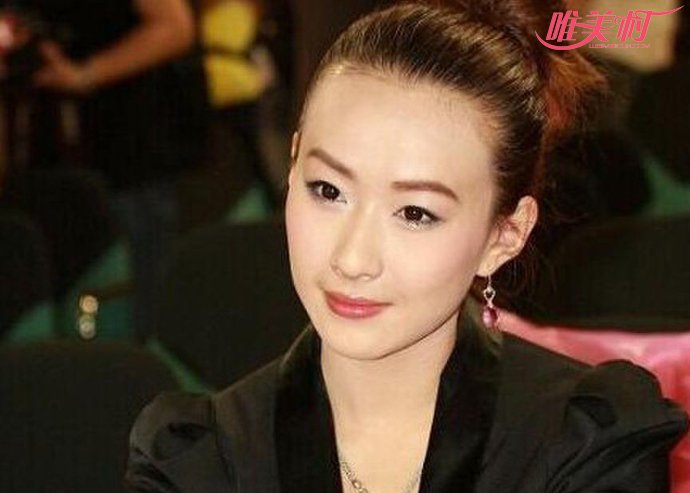 林晓芸 林晓芸
