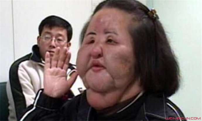 韩国风扇大妈是谁 模特韩美玉整容失败面目全非怪吓人