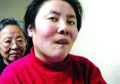 朱令现状