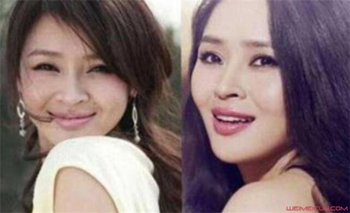 于明加整容前后照片 疑整残的样子和背后势力都吓死人了