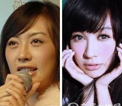 李菲儿整容前后对比照 整容后和杨颖很像