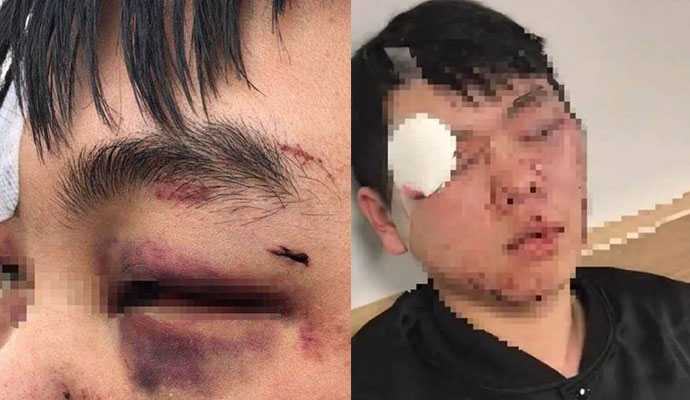 在澳留学生被围殴 在澳留学生被围殴