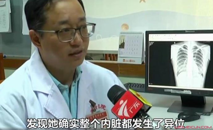 女子五脏六腑长反 女子五脏六腑长反