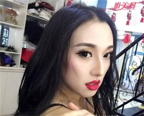 金兆丽变性后照片 金兆丽变性后照片