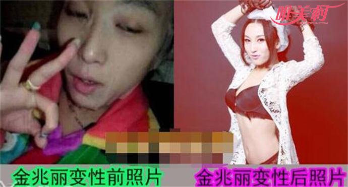 金兆丽变性前后照片 金兆丽变性前后照片