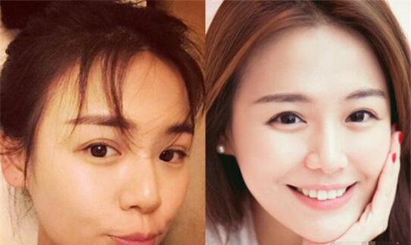 马思纯整容前后照片对比 马思纯整了那些部位