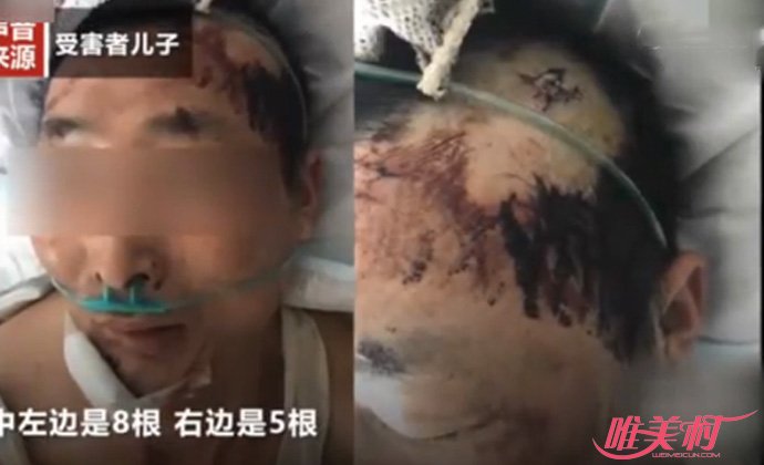 制止小孩乱跑遭打 制止小孩乱跑遭打