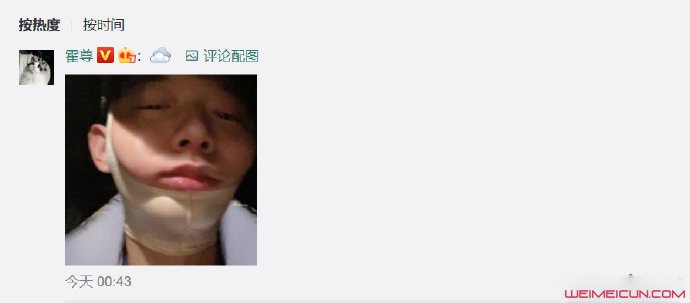 霍尊打哈欠下巴脱臼 霍尊打哈欠下巴脱臼