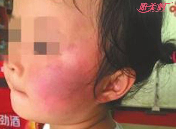 幼儿园让互扇耳光