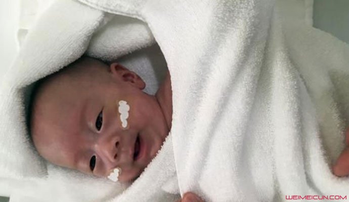 世界最小的男婴出院 世界最小的男婴出院