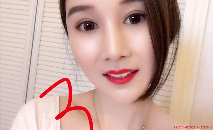 沈丽君自杀