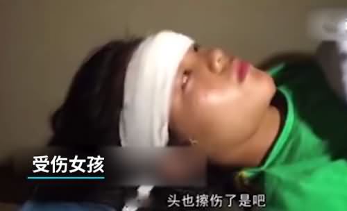 女孩表演杂技坠落