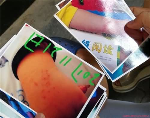 男童遭老师背摔