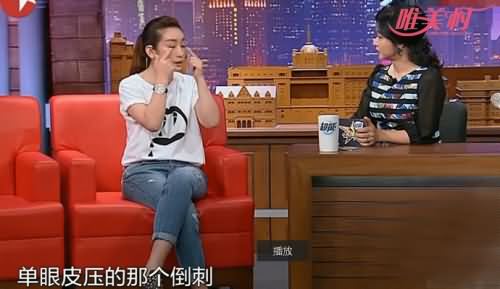 秦海璐割完双眼皮,秦海璐,秦海璐割双眼皮照片