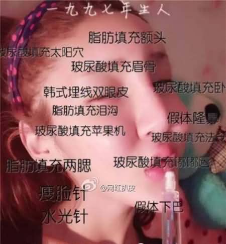 桃花宝宝是男的女的  桃花宝宝整容对比